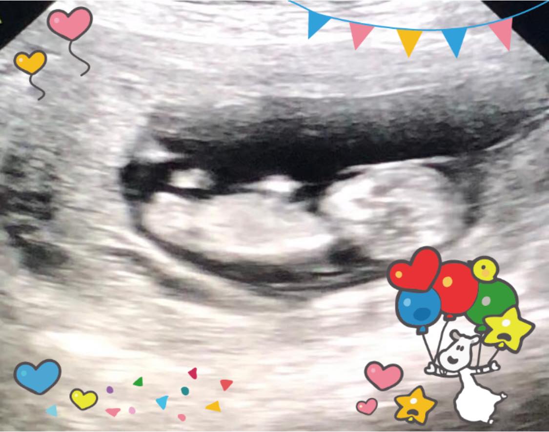 元旦報喜!朱芯儀宣布「懷上第3胎」 嫌家陽氣太重「秀超音波照」笑說:老公你大運來了