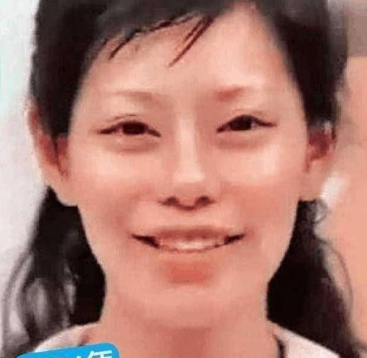 斯容18歲開始整形！22年來「超過60次」…外界批評聲浪不斷 她霸氣承認：乾你什麼事？