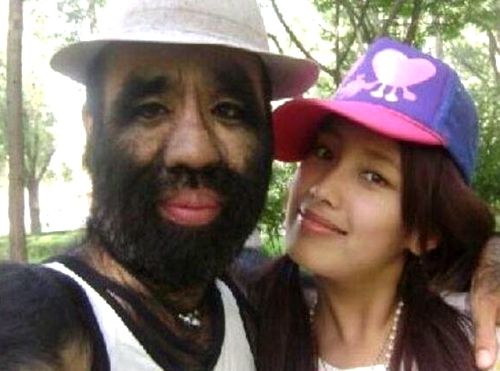 五官全覆蓋！她是世上毛髮最多的女性「被稱女版孫悟空」　剃光毛髮後「重拾自信心」美翻衆人：本尊好漂亮