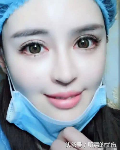 女孩自爆「整形失敗沒人要」拉下口罩的一瞬間，網友：就算失敗我也娶