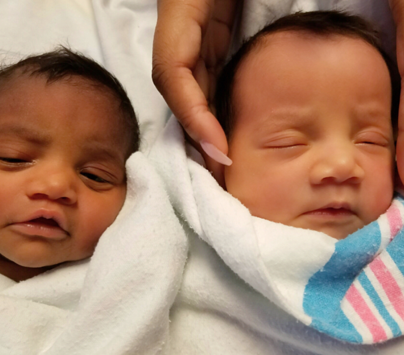 上帝創造的奇蹟！她生出「一黑一白雙胞胎」被酸：不同人種吧　長大後「超迷人電眼」連酸民也融化