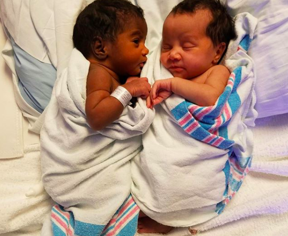 上帝創造的奇蹟！她生出「一黑一白雙胞胎」被酸：不同人種吧　長大後「超迷人電眼」連酸民也融化