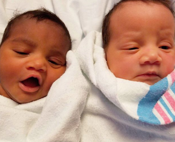 上帝創造的奇蹟！她生出「一黑一白雙胞胎」被酸：不同人種吧　長大後「超迷人電眼」連酸民也融化