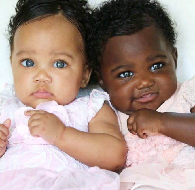 上帝創造的奇蹟！她生出「一黑一白雙胞胎」被酸：不同人種吧　長大後「超迷人電眼」連酸民也融化