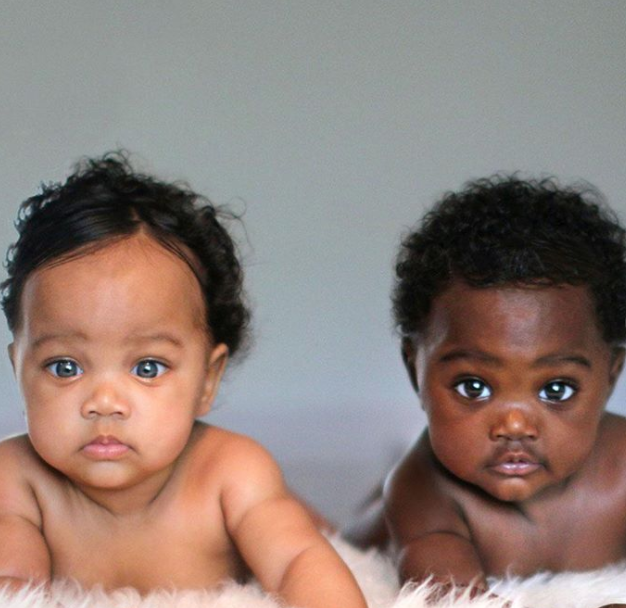 上帝創造的奇蹟！她生出「一黑一白雙胞胎」被酸：不同人種吧　長大後「超迷人電眼」連酸民也融化