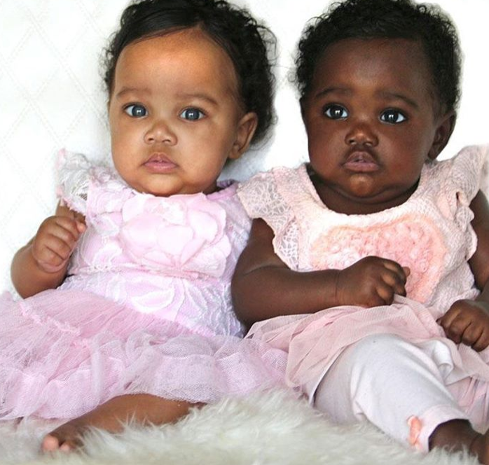 上帝創造的奇蹟！她生出「一黑一白雙胞胎」被酸：不同人種吧　長大後「超迷人電眼」連酸民也融化