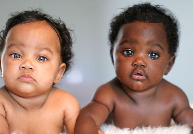 上帝創造的奇蹟！她生出「一黑一白雙胞胎」被酸：不同人種吧　長大後「超迷人電眼」連酸民也融化