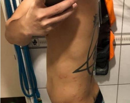 沒說有蟲!清潔人員「被上萬隻跳蚤咬」嚇到逃走 驚曝「一進到廚房超可怕」:1小時2千也不接