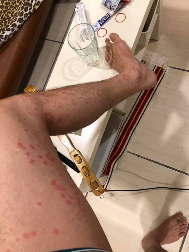 沒說有蟲!清潔人員「被上萬隻跳蚤咬」嚇到逃走 驚曝「一進到廚房超可怕」:1小時2千也不接