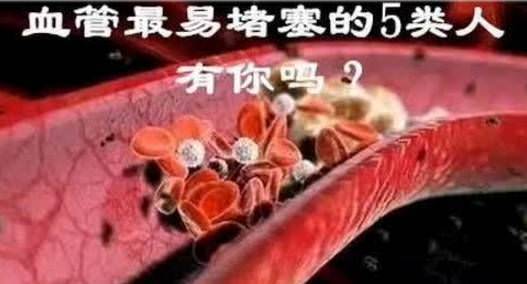 血管堵不堵塞！看看「頭髮」就知道　一看一個準：為自己收藏