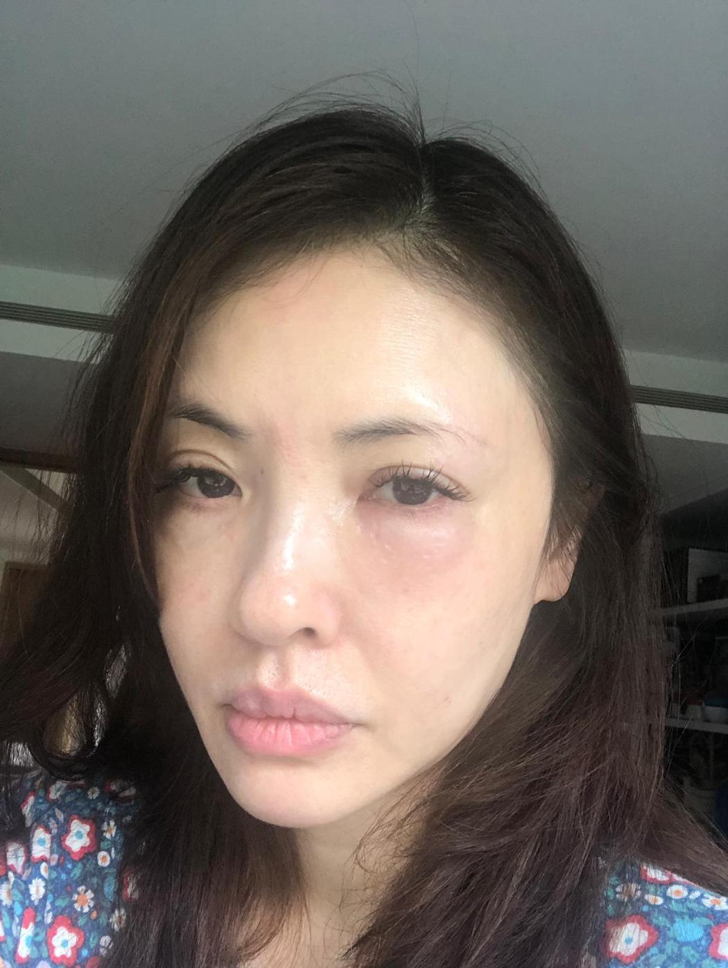 何如芸「左眼突腫三倍」仍敬業拍完8小時戲　「下午連跑3百貨」50歲凍齡戲裡外皆貴婦