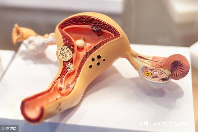 上廁所揪出女性問題！出現4大問題「更年期發病率提高」　10分鐘運動「改善血液循環」提升抵抗力