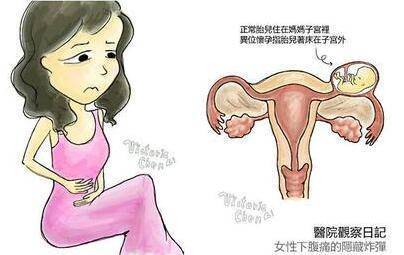 保護子宮至關重要！女性身體出現這5種情況  「說明子宮不好了」　尤其最後一個很傷身