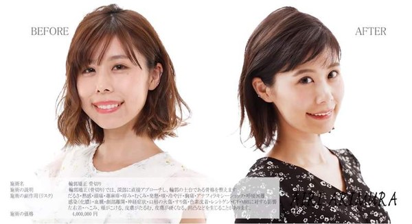 妹妹是超美女神！暴牙女星「被酸輸了好多截」 　砸100萬整形變「甜美大眼正妹」網驚：笑容好美