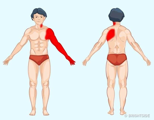 健康常識：9張圖解讓你秒懂「身體部位會疼痛的原因」　現在就找出問題「瞭解身體不適的原因」