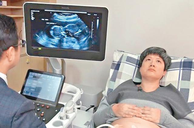 「52歲太太備孕9年」終於為他生下一女　心疼愛妻高齡生產命懸一線「花十多萬不嫌貴」