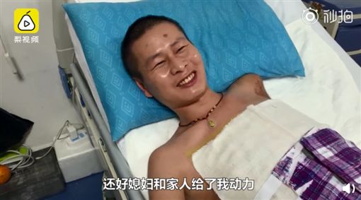 誤觸高壓電「四肢成黑炭」！妻子不離不棄「陪伴16次手術」 3歲女兒一句話讓他淚流不止