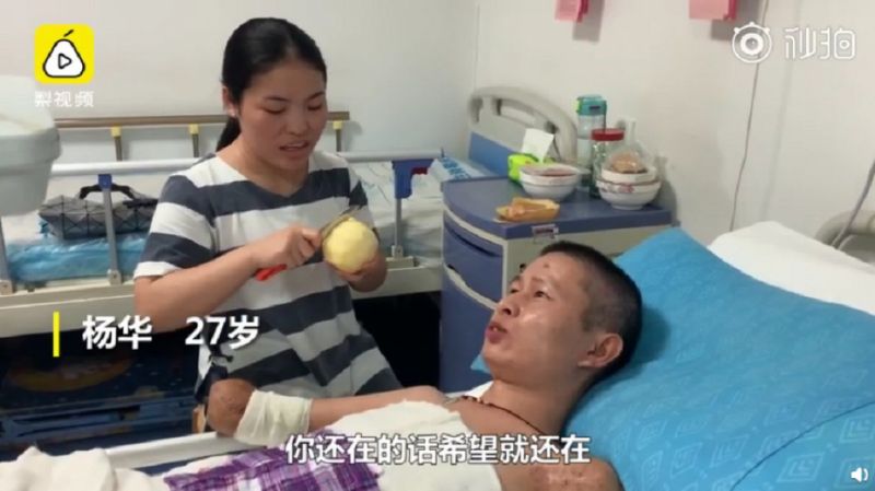 誤觸高壓電「四肢成黑炭」！妻子不離不棄「陪伴16次手術」 3歲女兒一句話讓他淚流不止
