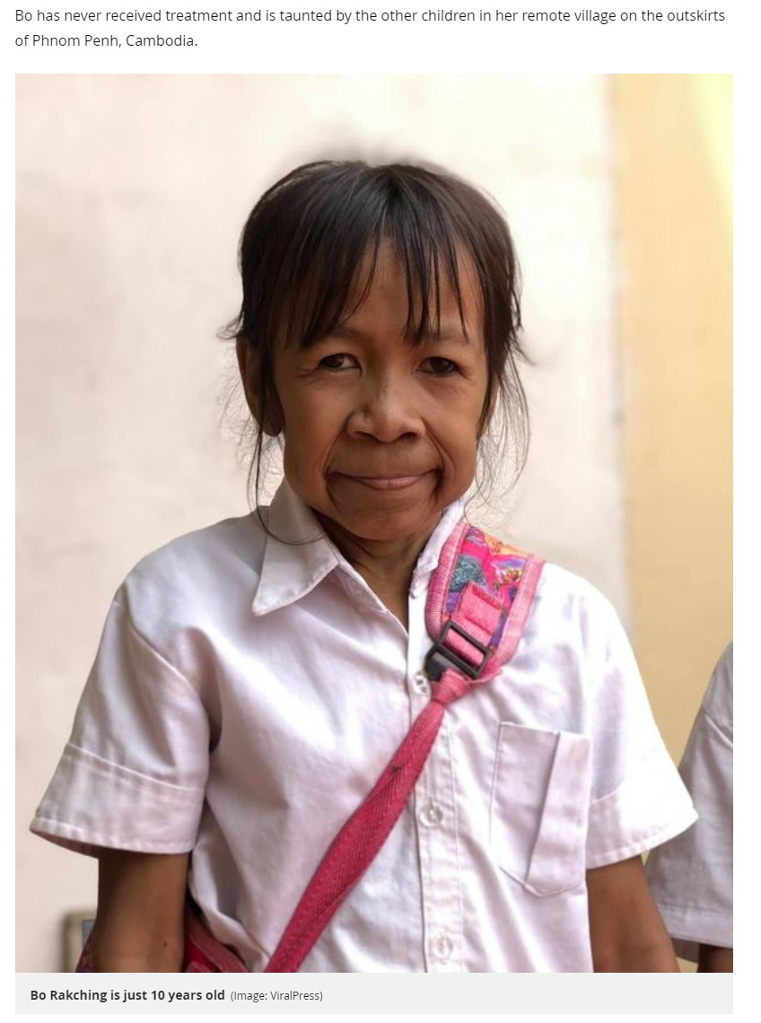 才10歲就滿臉皺紋！女童「外表像60歲阿嬤」連手足都笑她　到廟裡求助「看到媽媽摘花」僧侶秒懂