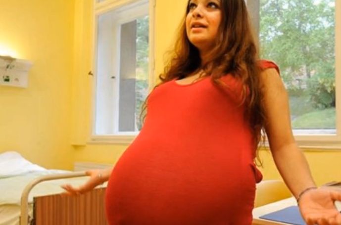 女子以為懷的雙胞胎，懷孕6個月去產檢才知道，自己創造了500年一次的奇蹟！