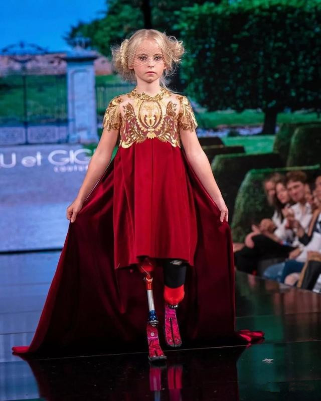 我命由我不由天！9歲「無腿」小模特「力壓世界名模」驚艷時裝周，用微笑擁抱命運之痛