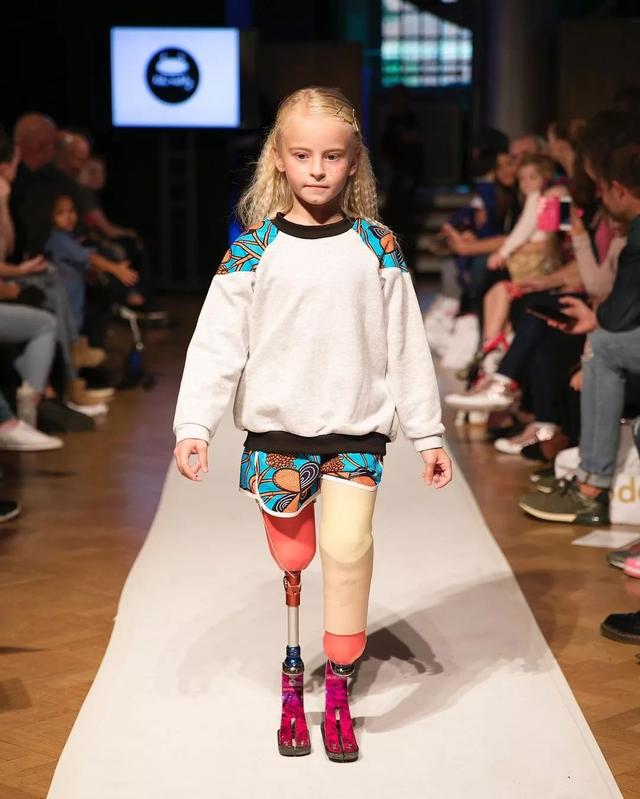 我命由我不由天！9歲「無腿」小模特「力壓世界名模」驚艷時裝周，用微笑擁抱命運之痛
