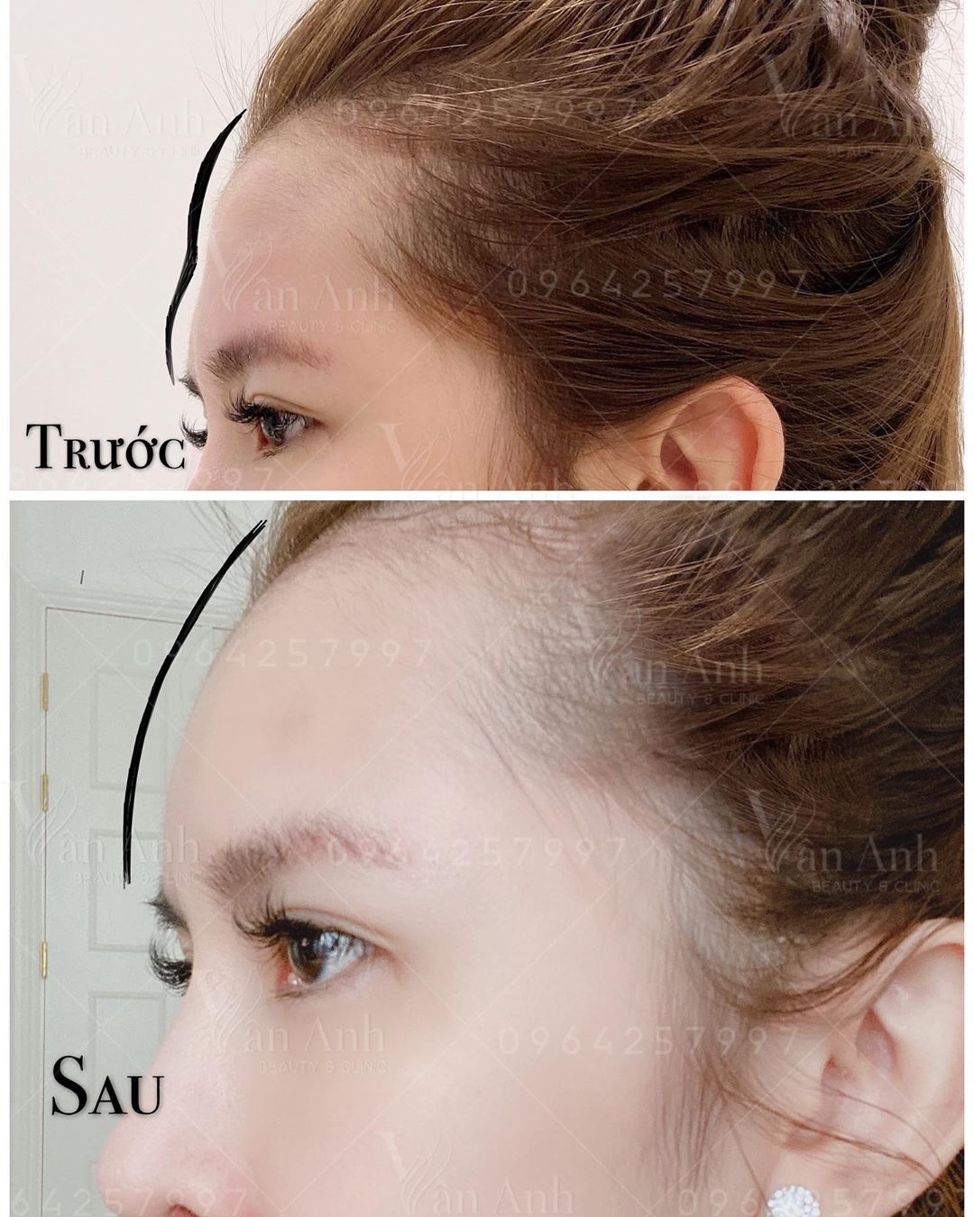 醜小鴨變天鵝!女大生「偷偷整形」變成網美臉 回家後「鄰居全不認得」媽媽也傻眼氣翻:別跟我說話