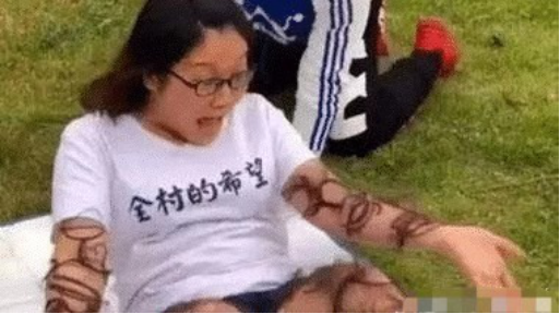 女子躺在草坪上睡覺，突然感覺手腳發癢，醒來看到「眼前的畫面」瞬間不淡定了