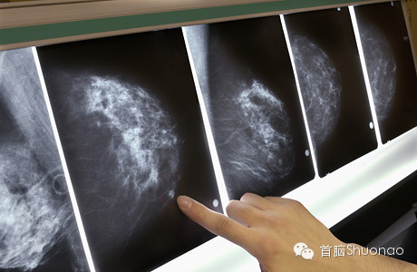 注意！專家示警：不要再買「這款胸罩」危害女人健康　嚴重會得乳腺癌