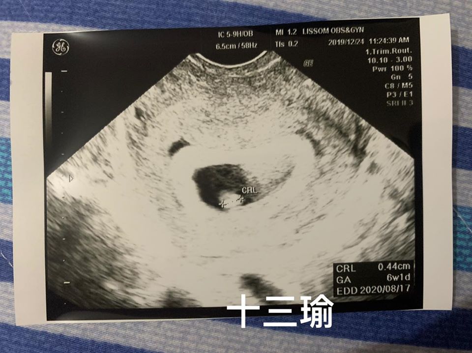 懷孕去產檢！醫生問「哪時候受孕」估算預產期　天兵尪秒回答「她尷尬想把人拖走」：不用這麼老實
