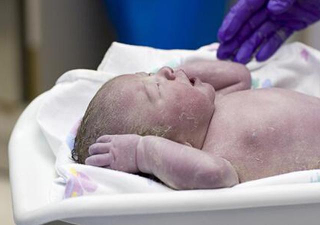 寶寶剛出生媽媽不敢認！膚色黑紫以為是「芋頭」成精，3個月後女兒顏值逆襲：吃可愛長大的