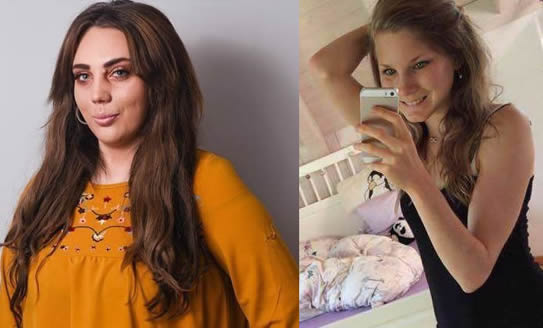 瘦到皮包骨！23歲姑娘厭食暴瘦至25公斤「走路都困難」     康復後逆襲：差點不敢認