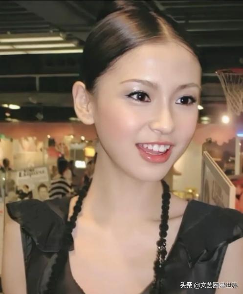 整牙堪比換臉？楊穎17歲「卸牙套後照片」曝光，「滿臉膠原蛋白+櫻桃小嘴」完全不像同一人