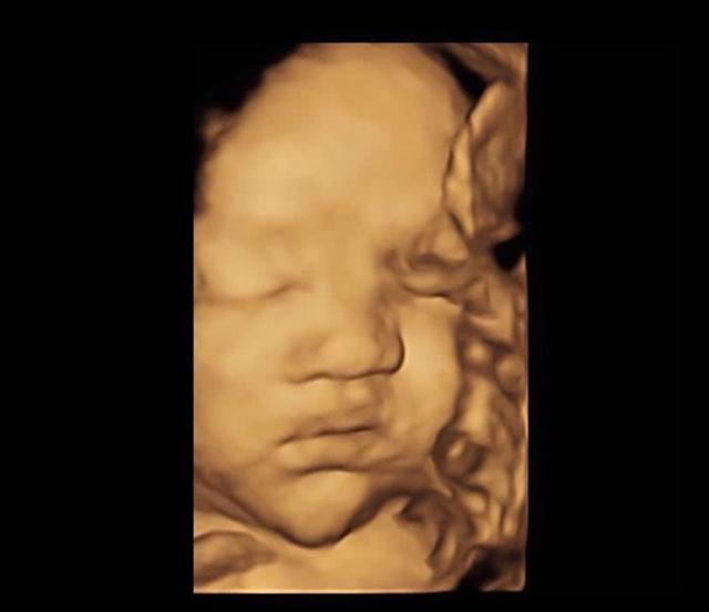 胎兒界的「數學天才」！孕婦照超音波發現胎兒在子宮裡「數數」超可愛     醫生：娘胎裡的學霸