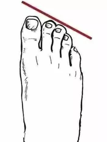 亞洲女人「腳型」一般分為4種：如若你是最後一種，夏天穿涼鞋會很好看，來認認你是哪種