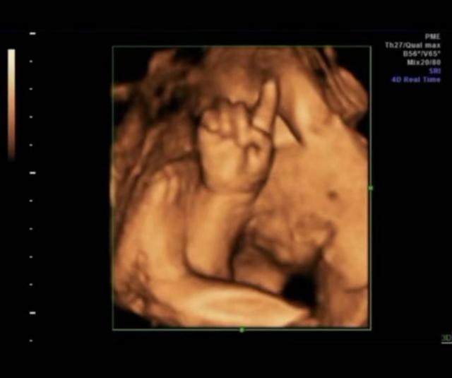 胎兒界的「數學天才」！孕婦照超音波發現胎兒在子宮裡「數數」超可愛     醫生：娘胎裡的學霸