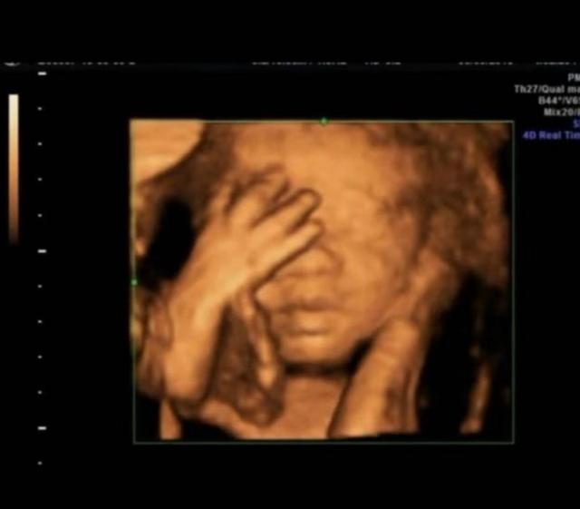 胎兒界的「數學天才」！孕婦照超音波發現胎兒在子宮裡「數數」超可愛     醫生：娘胎裡的學霸