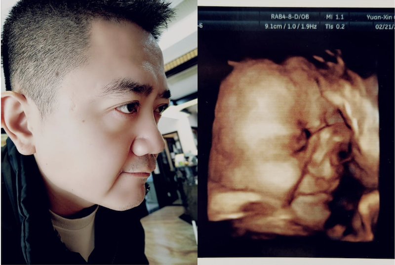 辛苦懷胎十月！寶寶出生「神複製老公模樣」媽媽氣到翻白眼　秀出超音波照「在肚子15週就注定好了」