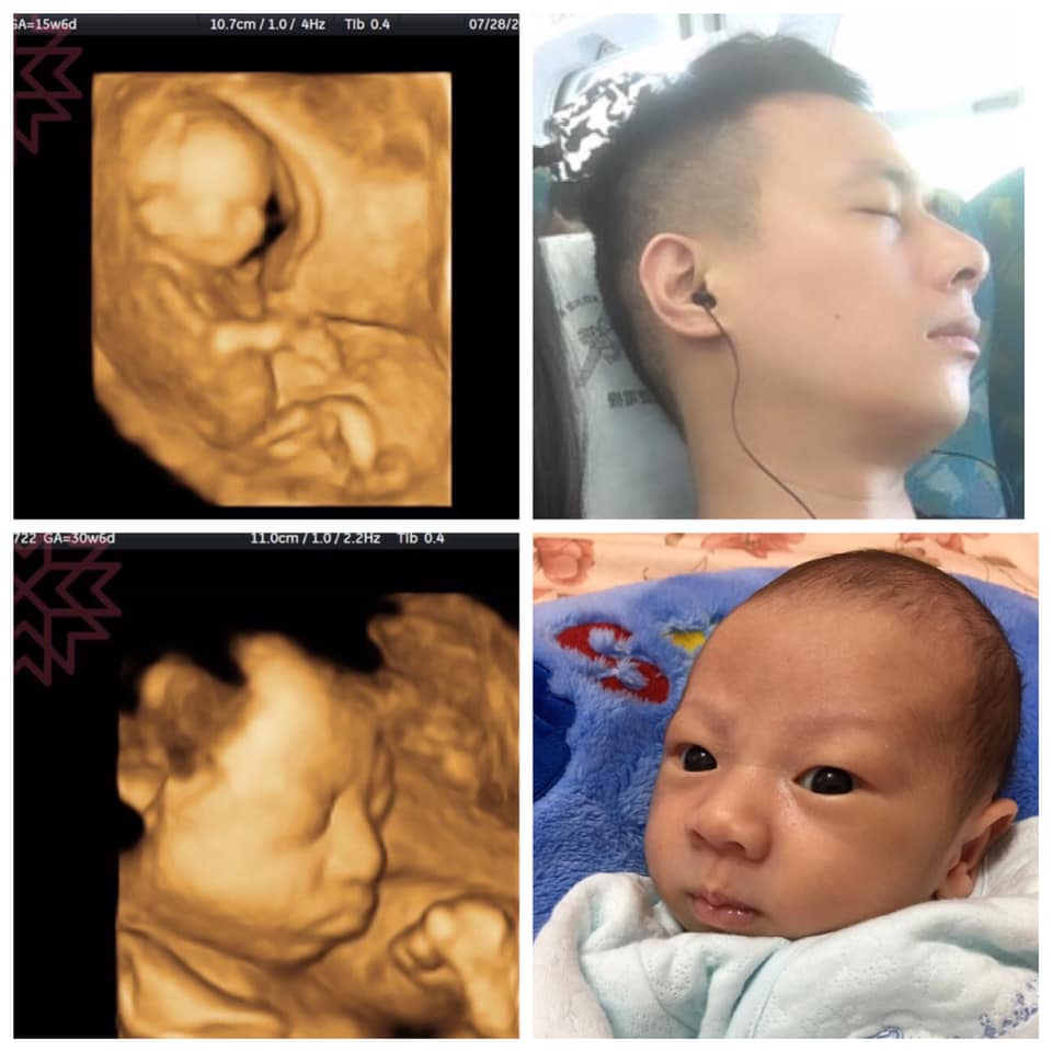 辛苦懷胎十月！寶寶出生「神複製老公模樣」媽媽氣到翻白眼　秀出超音波照「在肚子15週就注定好了」