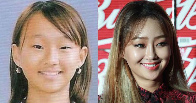 10位大方坦承「整形後變超正」的韓國明星　「為了給粉絲更好的自己」一切都值得