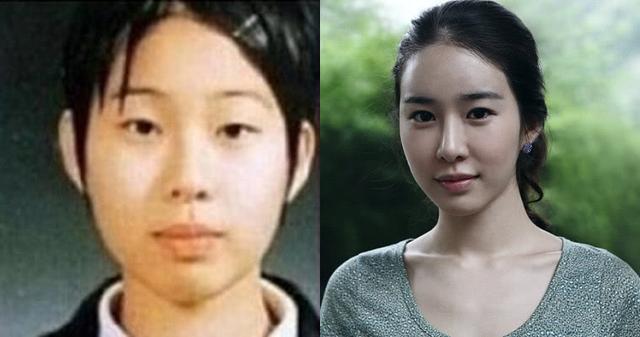 10位大方坦承「整形後變超正」的韓國明星　「為了給粉絲更好的自己」一切都值得