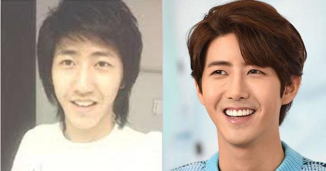 10位大方坦承「整形後變超正」的韓國明星　「為了給粉絲更好的自己」一切都值得