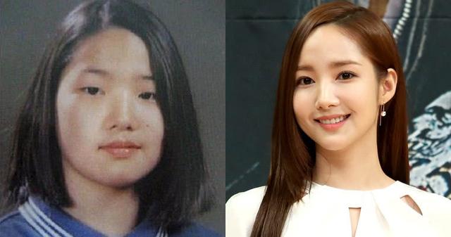 10位大方坦承「整形後變超正」的韓國明星　「為了給粉絲更好的自己」一切都值得