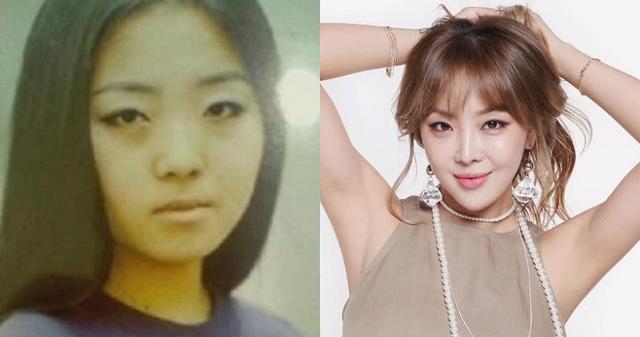 10位大方坦承「整形後變超正」的韓國明星　「為了給粉絲更好的自己」一切都值得