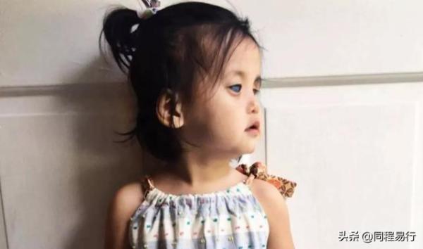 天生藍眼睛被棄！美國夫婦好心收養卻收到「健康警告」   用愛呵護「活成萬人羨慕的模樣」全網淚讃
