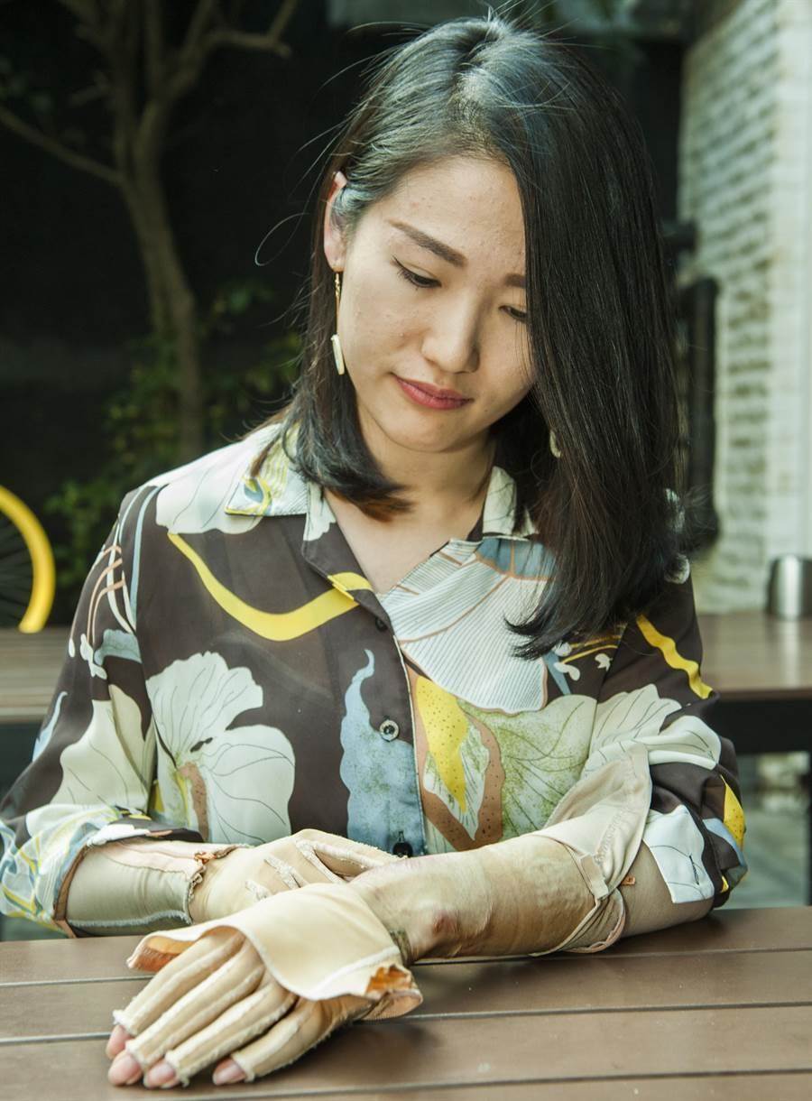 八仙事件5年了！空姐哽咽「9年初戀悔婚」成家夢碎　撐過最煎熬換藥「親手創造新人生」：幫助更多人