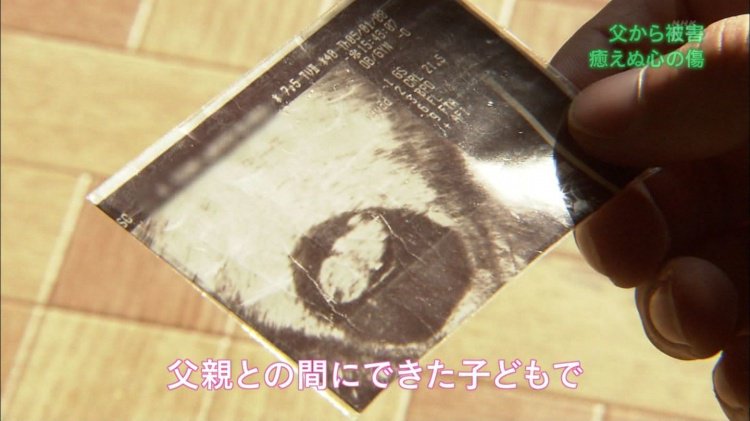 一家10口！二女兒自曝「孩子是爸爸的種」14歲就懷孕了　忍5年才逃離「獨自養大孩子」：上天何時能眷顧我