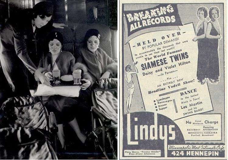 手腳沒共用！《驕女》演員被念「連體亂演」委屈落淚　真實連體姊妹「愛上有婦之夫」感情路讓人不捨