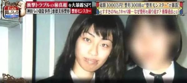 被親媽嫌醜！18歲女狂砸830萬「整形300次」 變電眼辣妹，為籌錢甘當陪酒女  自信喊：我要當模特兒