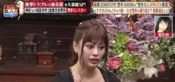 被親媽嫌醜！18歲女狂砸830萬「整形300次」 變電眼辣妹，為籌錢甘當陪酒女  自信喊：我要當模特兒